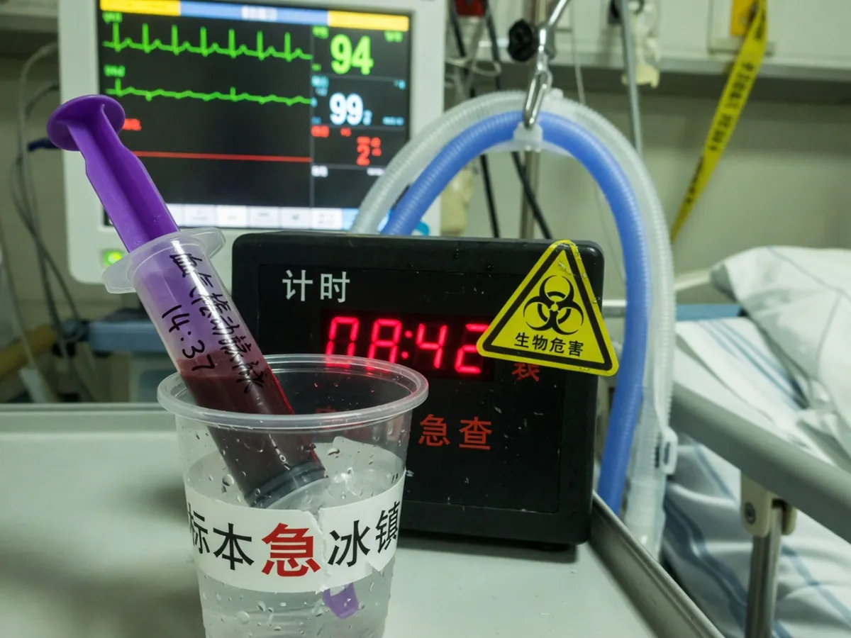 冰上动脉血与计时卡